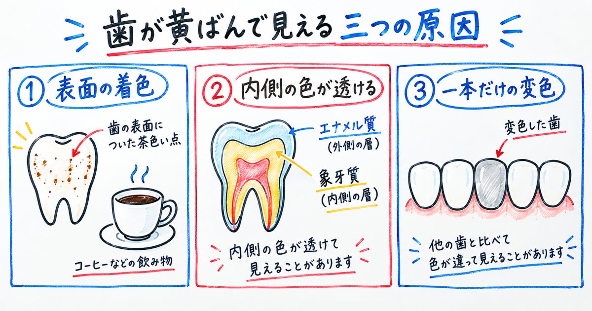 写真で歯が黄ばんで見えるのはなぜ？