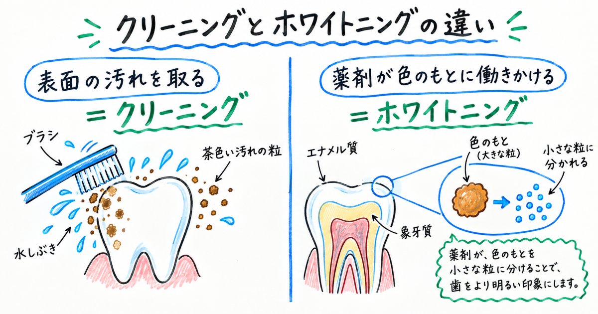 歯の黄ばみが白くなる仕組みとクリーニングの違い