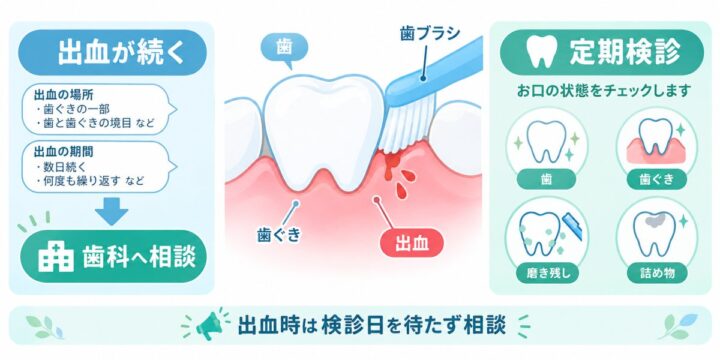 歯磨きで出血、痛みはない…歯科は症状が出てから？定期検診との違い