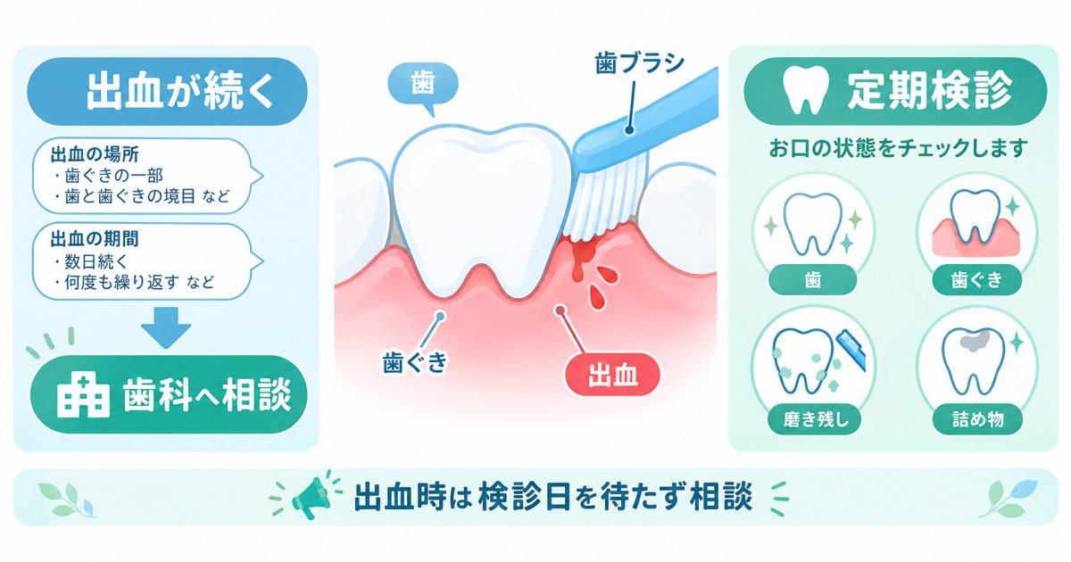 歯磨きで出血、痛みはない…歯科は症状が出てから？定期検診との違い